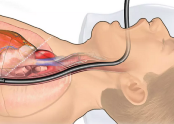 Discovering the Northern Endoscopy Centre Salisbury - Your Guide to Gastrointestinal Health