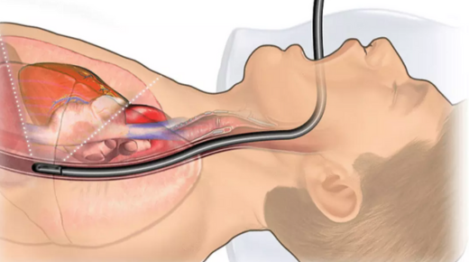 Discovering the Northern Endoscopy Centre Salisbury - Your Guide to Gastrointestinal Health