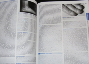 Understanding Harrison's Principles of Internal Medicine - A Comprehensive Guide