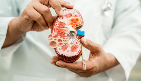 Nephrology Hospital in hyderabad