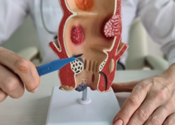 bleeding hemorrhoid treatment